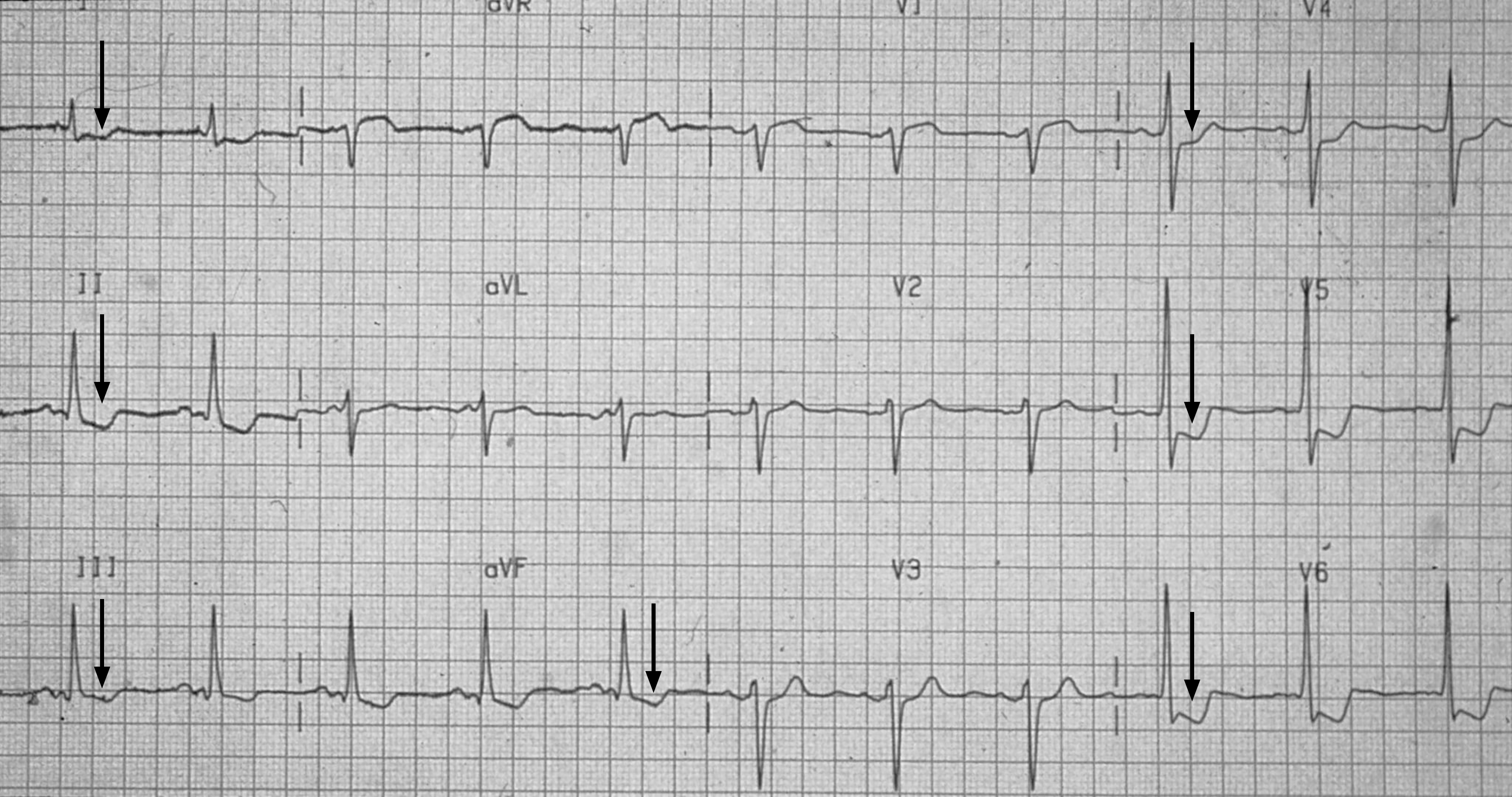 Elektrik des Herzens