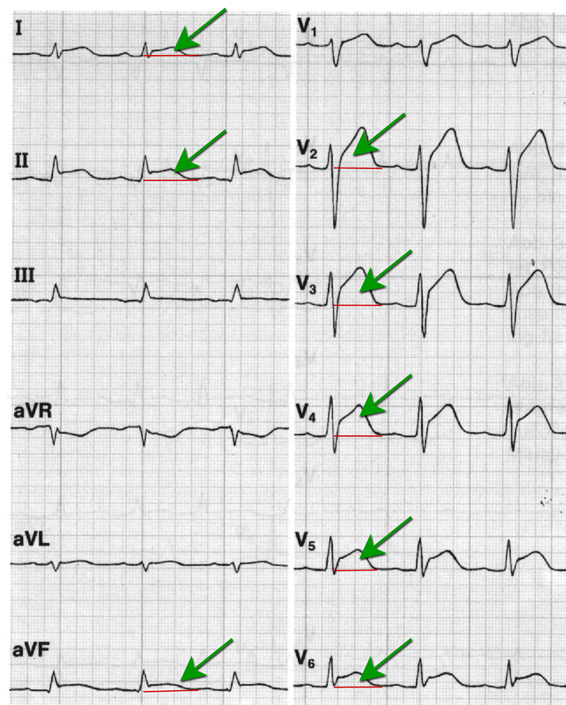 Elektrik des Herzens