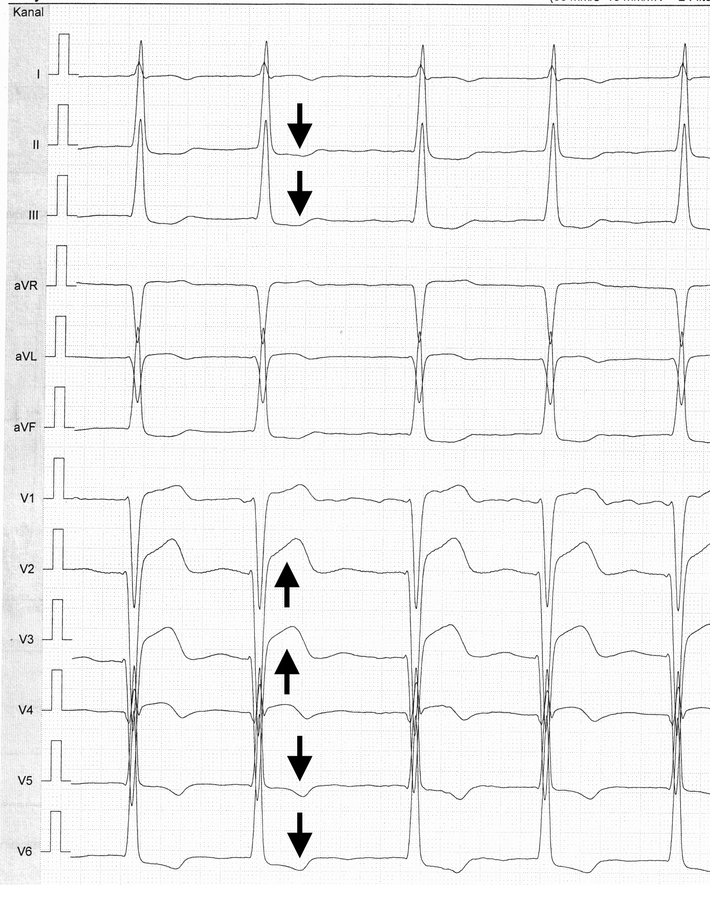 Elektrik des Herzens