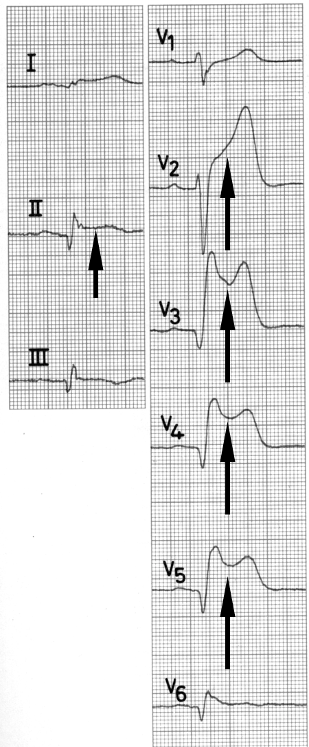 Elektrik des Herzens