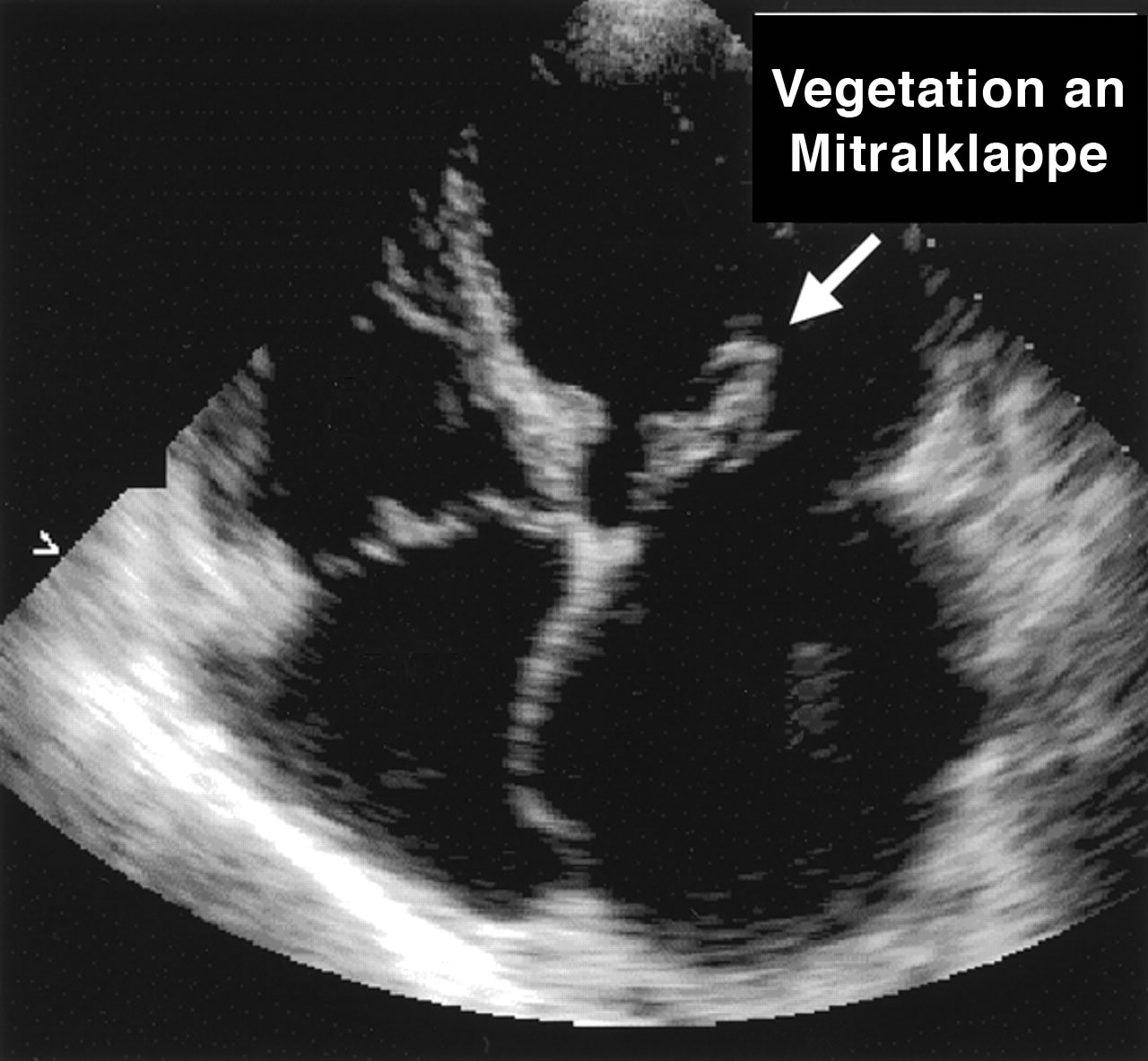 Vegetationen