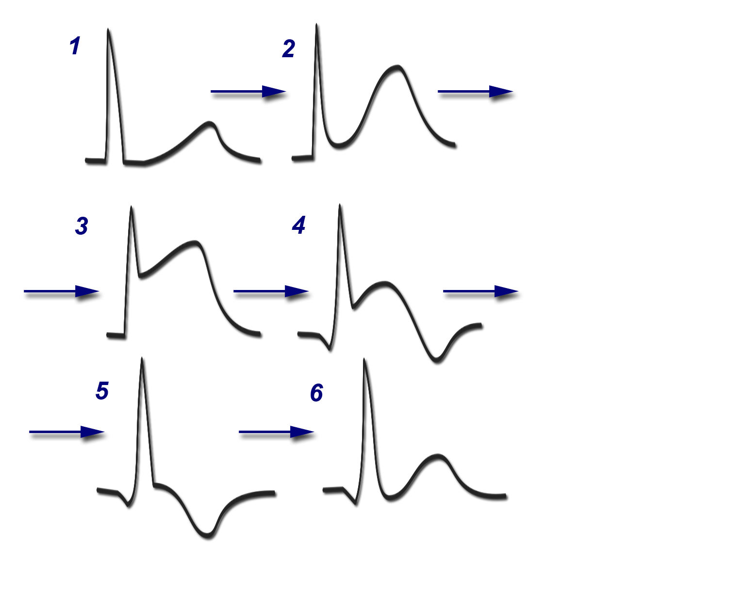 EKG-Verlauf1