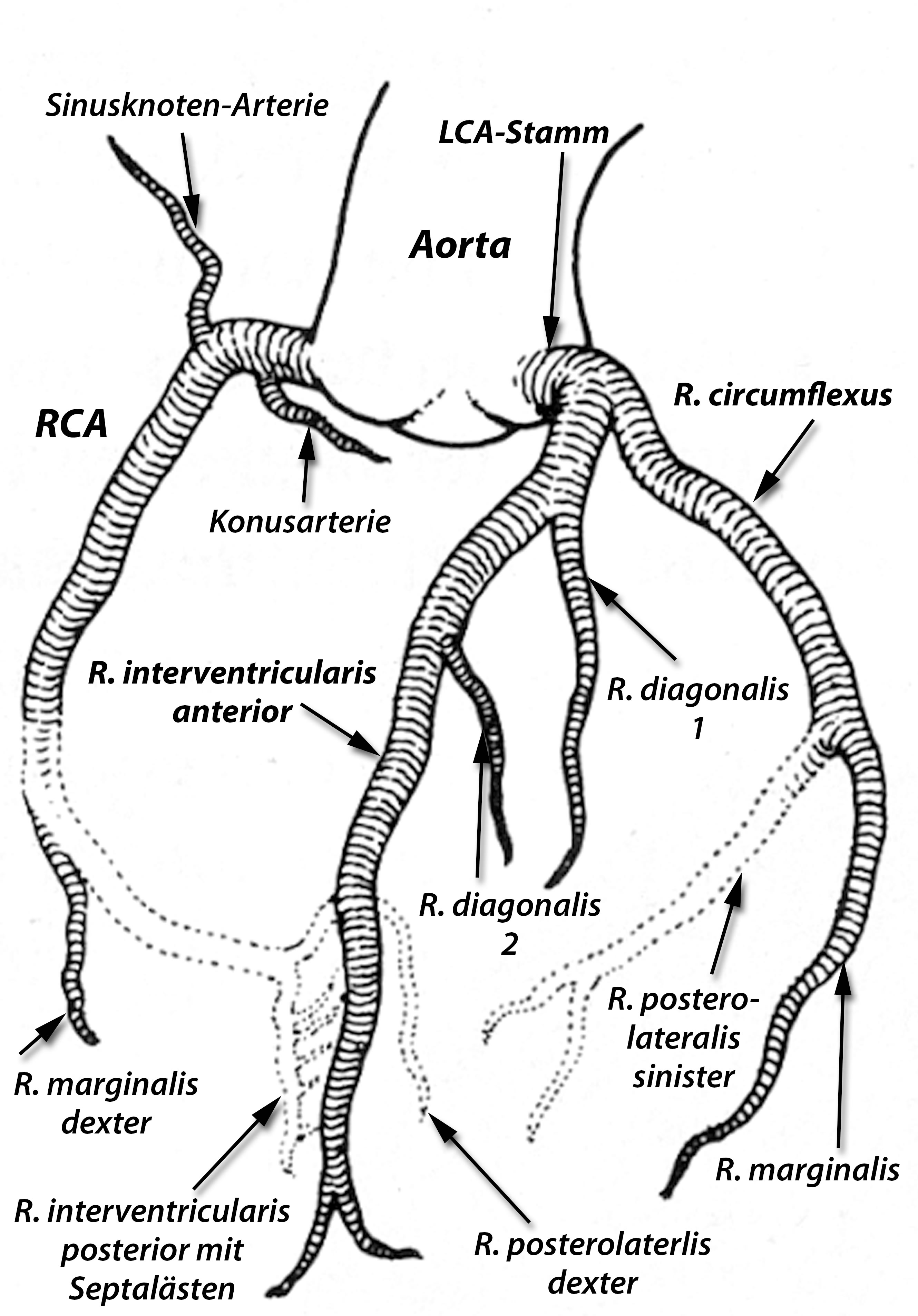 Koronararterien