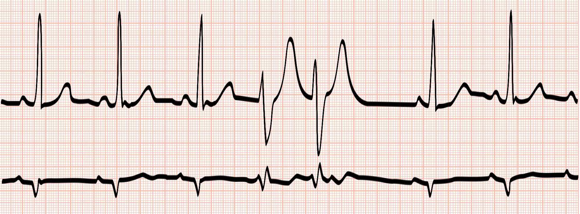 Elektrik des Herzens