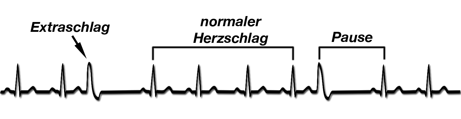 Elektrik des Herzens