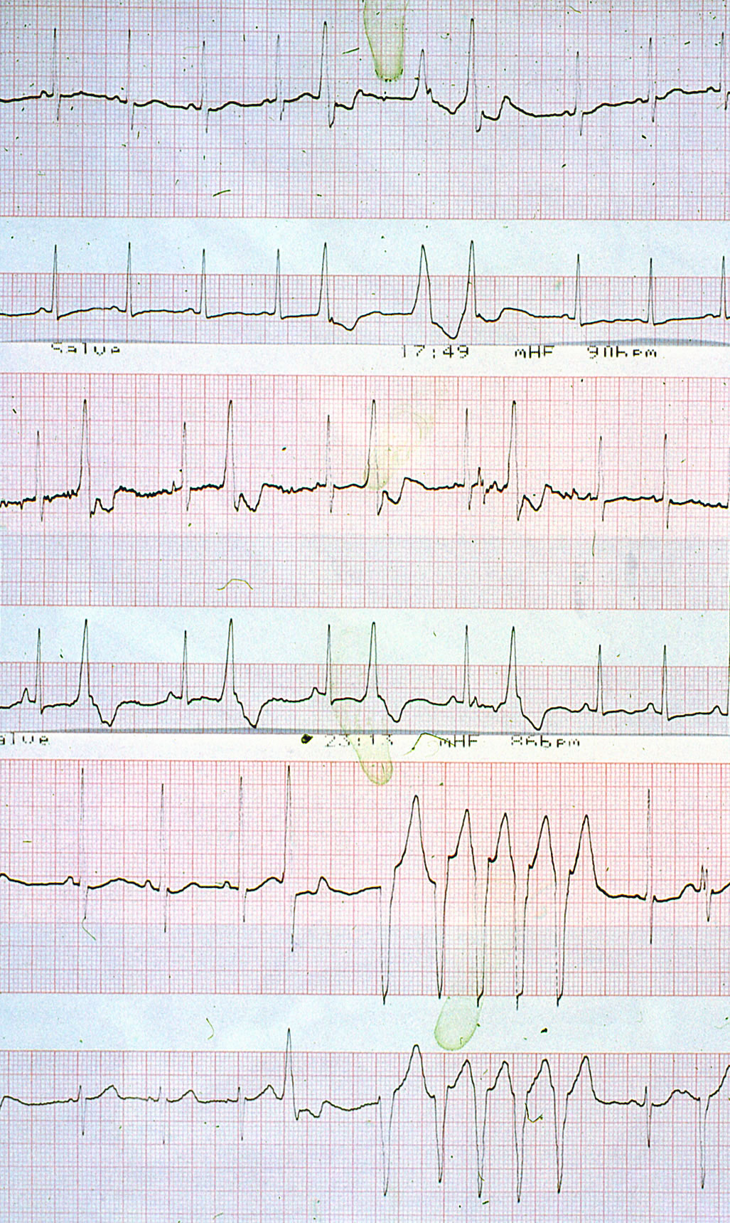Elektrik des Herzens