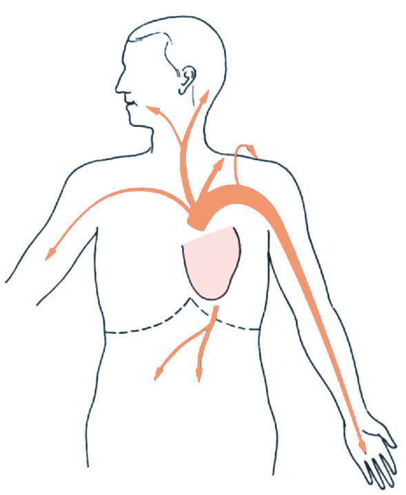 Angina pectoris