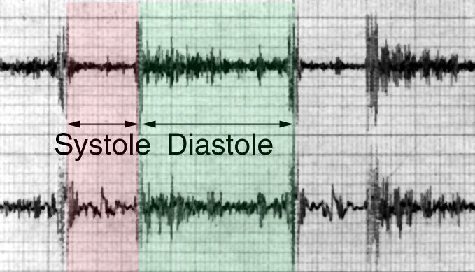 Systole und Diastole